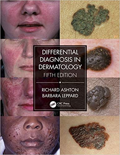 Differential Diagnosis in Dermatology (5th Edition) - Orginal Pdf
